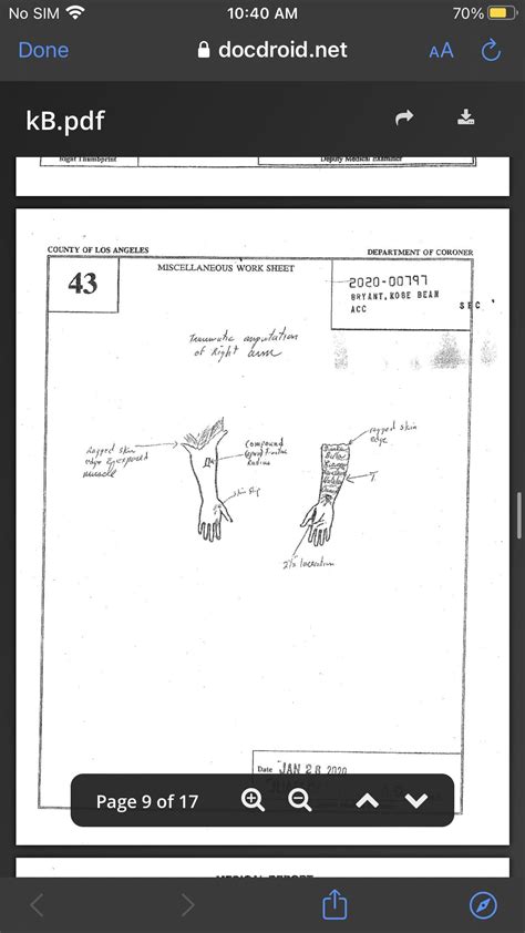 AUTOPSY REPORT performed an autopsy on the body of > the DEPARTMENT OF MEDICAL EXAMINER-CORONER Wo. . Bryant autopsy report pdf